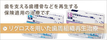 リグロスを用いた歯周組織再生治療