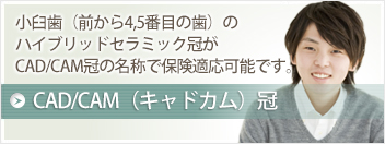 小臼歯（前から4,5番目の歯）のハイブリッドセラミック冠がCAD/CAM冠の名称で保険適応可能です。