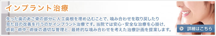 インプラント治療