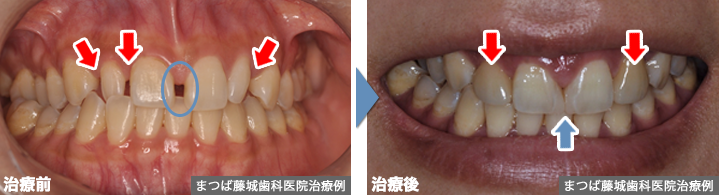当院の最新治療例 2017年度