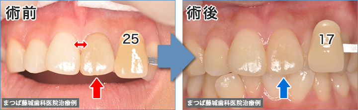 従当院の治療例