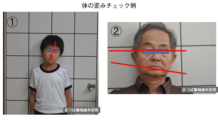体の歪みチェック例
