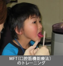 MFT(口腔筋機能療法)のトレーニング