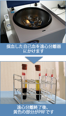 遠心分離