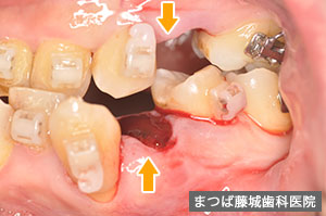訪問歯科診療