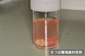 訪問歯科診療