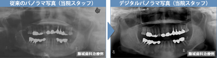 従来のパノラマ写真とデジタルパノラマ写真
